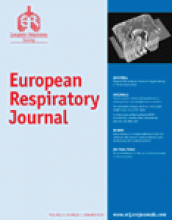 European Respiratory Journal: 29 (1)