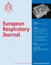 European Respiratory Journal: 29 (2)